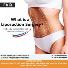 What is a Liposuction Surgery?

Liposuction is cosmetic surgery in which deposits of fat are removed to reshape or reduce one or more areas of the body. Common areas targeted include thighs, buttocks, abdomen, arms, neck and under the chin.
Contact us anytime with any questions you may have, or to schedule your consultation for liposuction surgeon in Delhi, India.
CONTACT US:-
Dr. Ajaya Kashyap
Web: www.bestliposuctionindia.com

#vaserliposuction #tummyfatremoval #bodyjetliposuction #liposuction #cosmeticsurgeryindia #plasticsurgeondelhi #drkashyap
