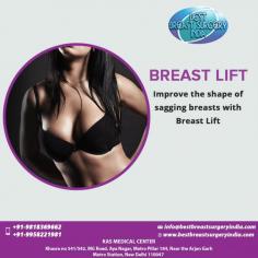 Breast lift surgery will help you to tighten and lift the breasts, to give a more youthful appearance.
If you have been thinking about getting a breast lift surgery in Delhi, Mastopexy procedure cost in India contact us for an appointment where we can discuss your requirements in more details. 
To schedule an appointment please call +91-9958221981.
Visit: www.bestbreastsurgeryindia.com

#BreastLift #Mastopexy #BreastLiftSurgery #Beforeandafter #DrKashyap #CosmeticSurgery #PlasticSurgeon #Delhi #India
