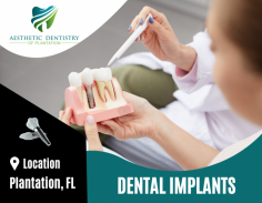  Permanent Solution for Your Damaged Teeth


Advancements in dentistry have the offer more flexibility to restore a missing tooth. A dental implant can be the best solution for lost teeth and helps maintain the bone in the edentulous area. Ping us an email at welcome@adpdentistry.com for more details.