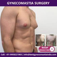 Gynecomastia surgery is performed by our expert plastic surgeon, Dr. Ajaya Kashyap. He is regarded as the best gynecomastia surgeon India due to his 26 years of surgical experience and being a Triple American Board certified Plastic Surgeon. The search to get the best gynecomastia surgery leads you to have your male breast reduction. Dr. Ajaya Kashyap, your specialist gynecomastia surgeon, may perform the procedure with liposuction and gland excision, or just liposuction alone.

Contact Dr. Kashyap Clinic (KAS Medical Center) at +91-9958221983, 9958221981 to book a consultation or ask us a question.
Check out more details: www.bestgynecomastiaindia.com

#Gynecomastia #MaleBreastReduction #CosmeticSurgery #PlasticSurgeon #Drkashyap #Delhi #India #medicaltourism
