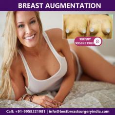 Dr. Ajaya Kashyap is a best cosmetic surgeon who provides treatment for breast augmentation surgery, breast implant surgery, breast augmentation by autologous fat transfer in Delhi at affordable cost.

Call now on +91-9958221981 to get instant appointments and take the opportunity to avail knowledgeable consultation of Dr. Ajaya Kashyap 

Email: info@bestbreastsurgeryindia.com
Web: www.bestbreastsurgeryindia.com
Book video call consultation please call/WhatsApp: +91-9958221981, 9958221983

#breastaugmentation #autologousfattransfer #breastimplant #breastenlargement #breastsurgeon #plasticsurgeonindia

