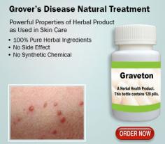 The rash from Grover’s Disease can be extraordinarily irritated. Natural Treatment drop itching usually start with high-power steroid creams, for example, triamcinolone or clobetasol, beside with antihistamines. Natural Remedies for Grover’s Disease provides the relief from skin disorders. It benefits to reducing rashes after skin that occur from Grover’s Disease.