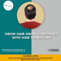 If you're looking for a permanent solution to your hair loss, you may want to consider a hair transplant.The outcome still depends largely on the surgeon you select. You want to choose a doctor who understands hair loss and performs hair transplants regularly. 
Consult your plan for hair transplant with our US Certified Plastic Surgeon via appointment at: 
Call or whatsapp +91-9958221983, 9289988888.
E-mail: info@besthairtransplantdelhiindia.com
Web: www.besthairtransplantdelhiindia.com
Book video call consultation please call/whatsapp: +91-9289988888, 9958221983

#hairtransplant #hairtransplantsurgeon #eyebrow #eyelash #beard #moustaches #cosmeticsurgery #plasticsurgeon #drkashyap #delhi #india
