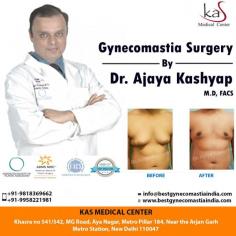 Are you suffering from male breast? Gynecomastia Surgery can help you get rid of the enlarged male breast. With no side effects attain beautifully shaped body. 
Consult your plan for gynecomastia surgery with our US Board Certified Surgeon via appointment.
Schedule a consultation by:
Phone: 9958221981
For Pricing: Text 9958221981

Website: www.bestgynecomastiaindia.com
Location: Khasra no 541/542, MG Road, Aya Nagar, Metro Pillar 184, Near the Arjan Garh Metro Station, New Delhi, India

#gynecomastia #malebreastreductionindelhi #cosmeticsurgery #realself #plasticsurgeon
