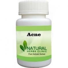 Herbal Treatment for Acne read the Symptoms and Causes. Acne is a common skin condition that develops when the hair follicles in your skin are blocked by dead skin and oil.
https://www.naturalherbsclinic.com/product/acne/
