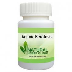 Herbal Treatment for Actinic Keratosis read the Symptoms and Causes. Actinic Keratosis is a scaly spot found on sun damaged skin.