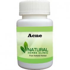 Herbal Treatment for Acne read the Symptoms and Causes. Acne is a common skin condition that develops when the hair follicles in your skin are blocked by dead skin and oil.