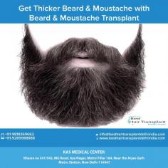Beard and Moustache contribute to the strong, masculine appearance of the face. Thick growth, groomed well give a nice, neat, impressive look. Unfortunately, thin hair density, abnormal and irregular shapes of the beard and moustache on the face gives a deserted, older and tired look.
If you have been thinking about getting a best hair transplant surgery in Delhi, beard hair transplant cost in India contact us for an appointment where we can discuss your requirements in more details. EMI Available Pay Easy Monthly Instalments

Schedule a consultation by:
Dr. Ajaya Kashyap
Email: info@besthairtransplantdelhiindia.com
Web: www.besthairtransplantdelhiindia.com
Call: +91-9958221983
For Pricing: Text +91-9958221983

Our Address: Khasra no 541/542, MG Road, Aya Nagar, Metro Pillar 184, Near the Arjan Garh Metro Station, New Delhi

#beard #moustache #beardtransplant #moustachetransplant #hairtransplant #hairreplacement #eyebrowtransplant #eyelashtransplant #mesotherapy #hairlosstreatment #prp #EMIoption #plasticsurgery #plasticsurgeon #Delhi #India #KasMedicalCenter 

