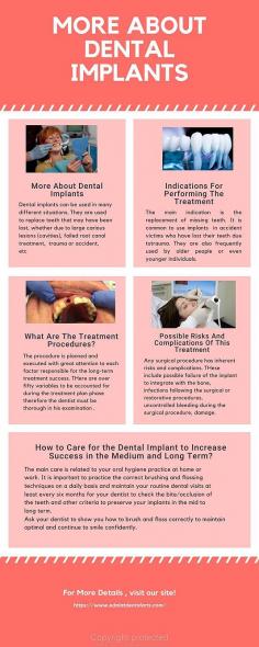 Know More About Dental Implants
