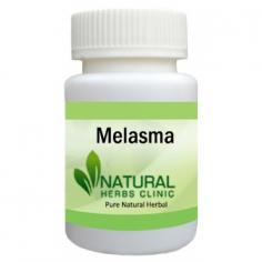 Herbal Treatment for Melasma read the Symptoms and Causes. Melasma is an acquired hyperpigmentation of the skin that typically affects the sun-exposed areas of the face.
https://www.naturalherbsclinic.com/product/melasma/
