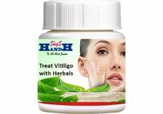 H and H Shops provide some Herbal Products for Vitiligo Spots Natural Treatment to treat the condition rapidly and without any side effects.