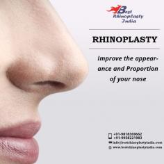 If you are thinking about getting a nose job, set up an appointment with your surgeon to discuss it. During that meeting, talk about your goals and tell the doctor what bothers you about your nose and how you would like to change it. Need Rhinoplasty (Nose Surgery) in Delhi, India. Meet Triple American Board Certified surgeon Dr. Ajaya Kashyap.
Dr. Kashyap has performed the Best Rhinoplasty Surgery in India, as seen in NAYA ROOP NAYI ZINDAGI SHOW (Extreme Makeover Show) telecasted on SONY TV in Year 2008. 
Take Video Consultation with our doctor from the comfort of your home. To book an appointment for Video Consultation Call or Whatsapp: +91-9958221982

Schedule a consultation by:
Dr. Ajaya Kashyap
Email: info@bestrhinoplastyindia.com
Web: www.bestrhinoplastyindia.com
Call: +91-9958221982
For Pricing: Text +91-9958221982
Location: Aya Nagar, New Delhi, India

#nosereshaping #nosejobcost #rhinoplasty #plasticsurgery #nosesurgeryindelhi #tipnose #realpatient #beauty #realself #cosmeticsurgery
