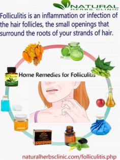 Colloidal silver is another one of the simple yet effective Natural Remedies for Folliculitis. It is effective against bacteria and fungi; hence it can deal with the root cause of the problem.
