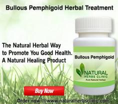 Herbal Treatment for Bullous Pemphigoid read the Symptoms and Causes. Natural Remedies for Bullous Pemphigoid or Supplement used to treat the condition.