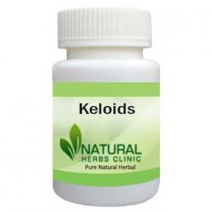 Herbal Treatment for Keloids read about Symptoms and Causes. Keloids are the result of an overgrowth of dense fibrous tissue that usually grows after healing of a skin injury.
