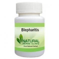 Herbal Treatment for Blepharitis read the Symptoms and Causes. Natural Remedies for Blepharitis treat the root of the problem. Supplement help to recover symptoms.
https://www.naturalherbsclinic.com/product/blepharitis/
