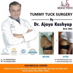 Tummy tuck surgery is good option for those women who have just finished having children often want to regain their pre-pregnancy figures. Contact us today inquire about abdominoplasty surgery cost in Delhi. Need Abdominoplasty procedure in Delhi, India. Meet Triple American Board Certified surgeon Dr. Ajaya Kashyap.

Take Video Consultation with our doctor from the comfort of your home. To book an appointment for Video Consultation Call or Whatsapp: +91-9958221983

Schedule a consultation by:

Dr. Ajaya Kashyap
Email: info@drkashyap.com
Web: www.drkashyap.com
Call: +91-9958221983
For Pricing: Text +91-9958221983
Location: Aya Nagar, New Delhi, India

#tummytuck #tummytucksurgery #abdominoplasty #abdominoplastycost #abdominoplastysurgeon #cosmeticsurgery #plasticsurgery #DrAjayaKashyap
