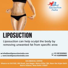 If you have been thinking about getting a liposuction surgery in Delhi contact us for an appointment where we can discuss your requirements in more details.
Share your whatsapp number, contact number or email id to get immediate help. You can also visit www.bestliposuctionindia.com to know details

Take Video Consultation with our doctor from the comfort of your home. To book an appointment for Video Consultation Call or Whatsapp: +91-9958221982
Schedule a consultation by:
Dr. Ajaya Kashyap
Email: info@bestliposuctionindia.com
Call: +91-9958221982
Location: Aya Nagar, New Delhi, India

#vaserliposuction #bodyjetliposuction #liposuction #armlipo #thighlipo #necklipo #transformation #cosmeticsurgery #realself #plasticsurgeon

