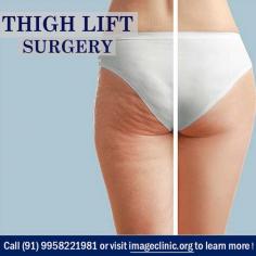 If fitness and weight loss efforts have not achieved your goals for a body that is firmer, more youthful-looking and more proportionate to your overall body image, a surgical thigh lift may be right for you.
In comparison to other places in the world, thigh lift surgery cost in India is very economical. You are welcome to contact our clinic, to enquire about the thigh lift surgery cost in Delhi

Interested? Call to make an appointment (995) 822-1982
visit: www.imageclinic.org

#thighliftsurgery #thighplastycost #plasticsurgerydelhi #imageclinic #thighliftsurgeondelhi #cosmeticsurgeryindia

