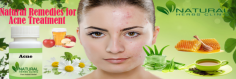 Natural Remedies for Acne Complete Natural Treatment
Witch Hazel very well knows herbal ingredients that used in Natural Remedies for Acne. This super-traditional ingredient often shows up in skincare products like toners because of its high level of tannins, which have proven antibacterial and anti-inflammatory properties.
https://www.naturalherbsclinic.com/blog/natural-remedies-for-acne-complete-natural-treatment/
