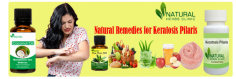 14 Natural Remedies for Keratosis Pilaris (Bumps on the Skin)
Coconut oil acts as one of the excellent Natural Remedies for Keratosis Pilaris, and it is good not only for your hair but for your skin as well (3). Its unique fatty acids soften the skin and provide nourishment from within.
https://www.naturalherbsclinic.com/blog/14-home-remedies-to-treat-keratosis-pilaris-bumps-on-the-skin/
