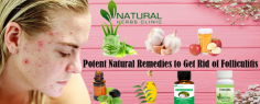 7 Potent Natural Remedies to Get Rid of Folliculitis
Witch hazel is doubtless one of the most proficient Natural Remedies for Folliculitis. Directly applying witch hazel over the parts that are prone to get swollen hair follicles, assist decrease the redness and swelling.
https://www.naturalherbsclinic.com/blog/7-potent-natural-remedies-to-get-rid-of-folliculitis/
