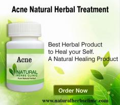 Herbal Treatment for Acne read the Symptoms and Causes. Natural Remedies for Acne can help you get rid of them completely. Supplement may help remove acne scars.
