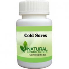 Herbal Treatment for Cold Sores read the Symptoms and Causes. Natural Remedies for Cold Sores help relieve the pain. Supplement for effective relief.
