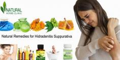 Utilization of Indian lilac in Natural Remedies for Hidradenitis Suppurativa can be beneficial in treating the disease fast and secure.
https://www.dubaient.com/natural-remedies-for-hidradenitis-suppurativa
