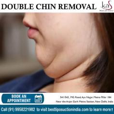 Chin Liposuction is best suited individuals with fat deposit beneath the chin. Get the best double chin removal surgery in India at KAS Medical Center. For any kind of enquire about chin reduction surgery please complete our contact form or call +91-9958221983 or +91-9958221982.

Dr. Ajaya Kashyap Triple American Board certified Plastic Surgeon with over 30 years of experience in which 16 years in the U.S.A. & from the past 14 years he is in Delhi. You can learn more about on his website - www.bestliposuctionindia.com

We are offering VIRTUAL CONSULTATIONS so that we can all stay connected during this time! 

#doublechinremoval #doublechinreduction #chinliposuction #cosmeticsurgery #plasticsurgeon #drkashyap #Delhi #India #medicaltourism

