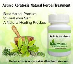 Herbal Treatment for Actinic Keratosis read the Symptoms and Causes. Natural Remedies for Actinic Keratosis and Supplement reduce the spots on the skin.
