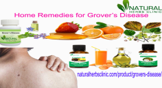 Witch hazel can be used as a Natural Remedies for Grover’s Disease. It is awesome Natural Cure for Grover’s Disease many skin problems. This natural cure has cooling properties which are very effective for hair removal bumps or dry skin.
https://herbsnaturalclinic.weebly.com/blog/grovers-disease-natural-treatment-at-home
