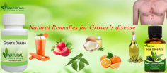 Here are common Natural Remedies for Grover’s Disease that might assist you in finding out a few alleviations and deal with your situation in a better technique.
