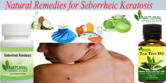 You can use fish oil as your Natural Remedies for Seborrheic Keratosis. Also, you can use a krill oil supplement. Both home remedies can help you to rid of the toxic rancid fat as well as from preventing it to accumulate in the body.
https://www.naturalherbsclinic.com/blog/natural-remedies-for-seborrheic-keratosis-to-get-rid-of-it/
