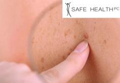 At Safe Health & Med Spa, Our skin cancer clinics offer a rapid diagnostic and treatment service for melanoma and squamous cell carcinoma. Our team of dermatologists treat all types of skin cancer using the latest research and treatment options. For more information, visit our website. https://www.safehealthcenter.com/skincare-services/skin-cancer-treatment/