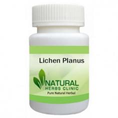 Herbal Treatment for Lichen Planus read the Symptoms and Causes. Natural Remedies for Lichen Planus used to reduce the pain. Supplement reducing burning sensation.
