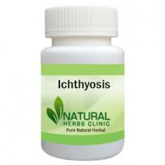 Herbal Treatment for Ichthyosis read the Symptoms and Causes. Natural Remedies for Ichthyosis may help soften your skin. Supplement can help prevent dryness.
