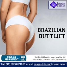 A Brazilian butt lift is a popular cosmetic procedure that involves the transfer of fat to help create more fullness in your backside.

Dr. Ajaya Kashyap Triple American Board certified Plastic Surgeon with over 35 years of experience. He practices state of the art Plastic and Cosmetic Surgery in South Delhi and Gurugram areas, making cutting edge advances in Aesthetic Surgery. He is currently the Medical Director of KAS Medical Center and Director of Plastic Surgery at MedSpa, New Delhi.

We are offering ONLINE VIDEO CONSULTATIONS so that we can all stay connected during this time! 


Schedule a consultation by:
Dr. Ajaya Kashyap
Web: www.imageclinic.org
Location: Aya Nagar, New Delhi, India

#BrazilianButtLift #hipsurgery #fattransfer #ButtLift #Liposuction #CosmeticSurgery #MedSpa #DrAjayaKashyap
