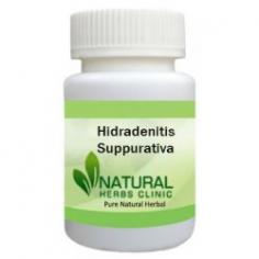 Herbal Treatment for Hidradenitis Suppurativa read about Symptoms and Causes. Natural Remedies for prevent new boils from forming. Supplement can help manage symptoms.
https://www.naturalherbsclinic.com/product/hidradenitis-suppurativa/
