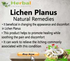 Herbal Treatment for Lichen Planus helps reduce the inflammation that contributes to the condition. Herbal Remedies for Lichen Planus used to treat or reduce the symptoms.