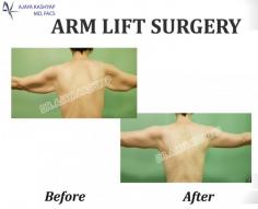 

Arm Lift or Brachioplasty is  done surgically with varying length of incision depending on the extent of skin laxity and the technique used. Book an appointment with Dr. Ajaya Kashyap, a specialist facelift surgeon in Delhi, India.

Please visit our website: www.drkashyap.com

We are offering VIRTUAL CONSULTATIONS so that we can all stay connected during this time!

#armlift #armliftinindia #brachioplasty #armliftindelhi #cosmeticsurgerydelhi #plasticsurgery #drkashyap

