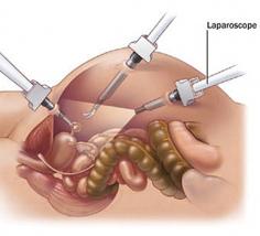 Dr. Sundeep Jain offers personalized esophageal cancer treatment in Jaipur with world class facilities. To Know more about esophageal surgery, contact us today
https://drsundeepjain.com/esophageal-cancer-surgery/
