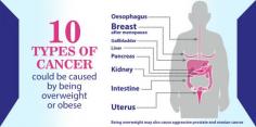 Obesity and Cancer Treatment in Delhi | Dr. Priya Tiwari