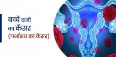 Uterine Cancer Treatment Specialist in Gurugram, Gurgaon, Delhi