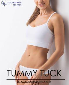 
Tummy tuck or abdominoplasty is best done when a woman has completed her family but if there is excessive laxity and subsequent pregnancies are not planned for several years, the procedure can be undertaken with the understanding that the procedure may have to be revised subsequently.

Let your search for the best Tummy tuck procedure in Delhi come to an end with best abdominoplasty surgeon in India, Dr. Ajaya Kashyap. With an experience spanning over 35 years in the field of cosmetic and plastic surgery, he has emerged as the leading cosmetic and plastic surgeon in India.

Please visit our website: https://www.drkashyap.com/cosmetic-plastic-surgery/tummy-tuck.html

We are offering VIRTUAL CONSULTATIONS so that we can all stay connected during this time!

#tummytuck #tummytucksurgery #abdominoplasty #minitummytuck #abdominoplastycost #abdominoplastysurgeon #cosmeticsurgery #plasticsurgery #DrAjayaKashyap