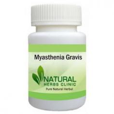 Garlic is one of exceptionally helpful sustenance as a Natural Remedies for Myasthenia Gravis. Take some crude garlic cloves and apply them to the impacted reaches.
