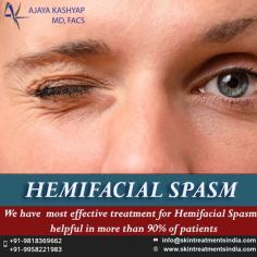 Hemifacial Spasm (HFS) is a neuromuscular disorder, generally observed in middle-aged men and women, and it inflicts the muscles of one side of the face. For further information regarding Hemifacial Spasm Treatment, please visit our website at www.skintreatmentsindia.com or write to us at info@skintreatmentsindia.com
