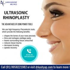 An ultrasonic rhinoplasty uses specialized tools to reshape the nasal bones for a more refined nose shape. During an ultrasonic rhinoplasty, an open technique will be used for better exposure of the nasal bone.

Schedule a consultation by:
Dr. Ajaya Kashyap
Email: info@drkashyap.com
Web: www.drkashyap.com
Call: +91-9958221983/82/81

#NoseSurgery #RhinoplastySurgeon #piezoelectricrhinoplasty #NoseSurgeon #CosmeticSurgery #CosmeticSurgeon #PlasticSurgery #PlasticSurgeon #DrAjayaKashyap #DrKashyap
