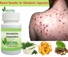 Several prescribed Natural Remedies for Hidradenitis Suppurativa and dietary supplements for this skin disorder include nutrition C, B-complex, omega dietary supplements, Zinc Gluconate, and Burdock root.