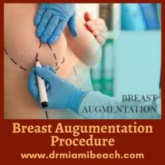 Breast Augmentation Procedure in Miami Beach